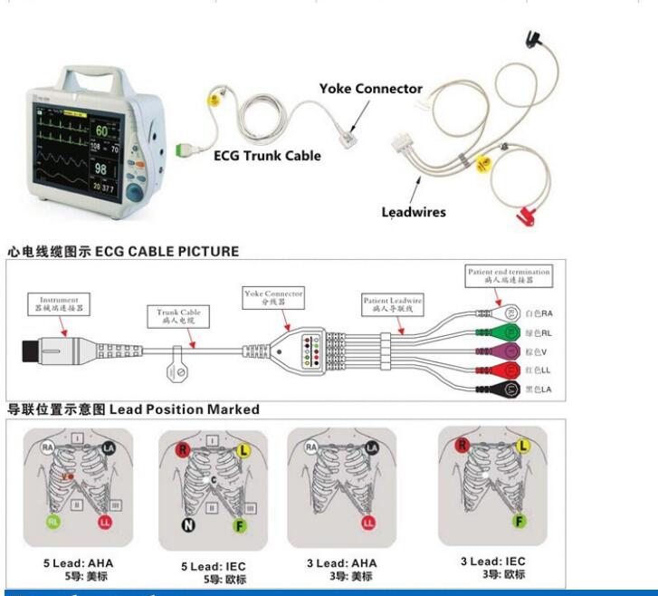 ecg picture